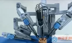 《最强蜗牛》达芬奇手术机器人简介